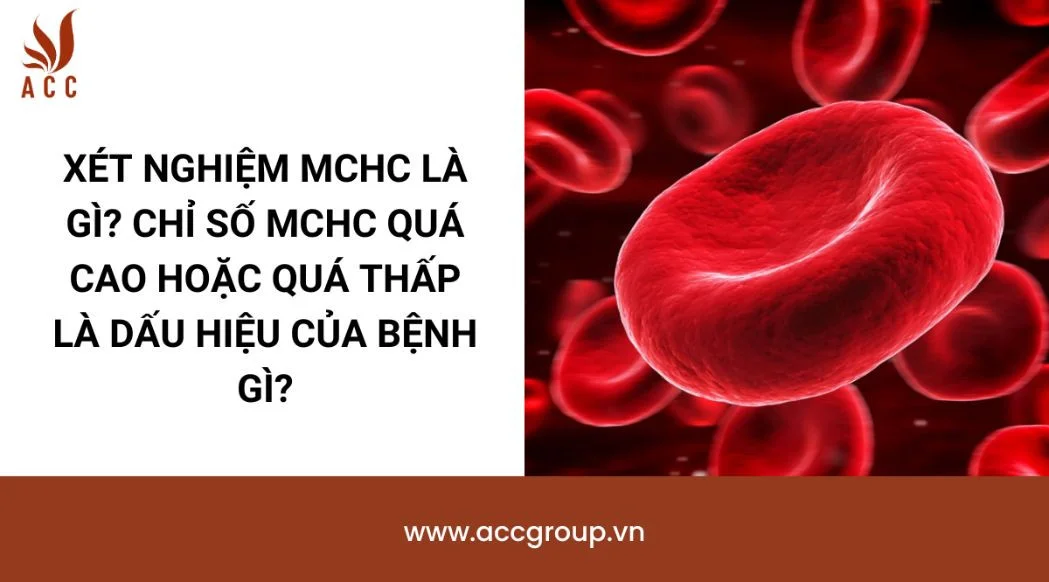 Xét nghiệm MCHC là gì? Chỉ số MCHC quá cao hoặc quá thấp là dấu hiệu của bệnh gì?