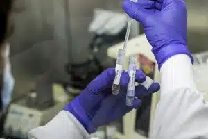 Xét Nghiệm Covid19 Gộp Là Gì
